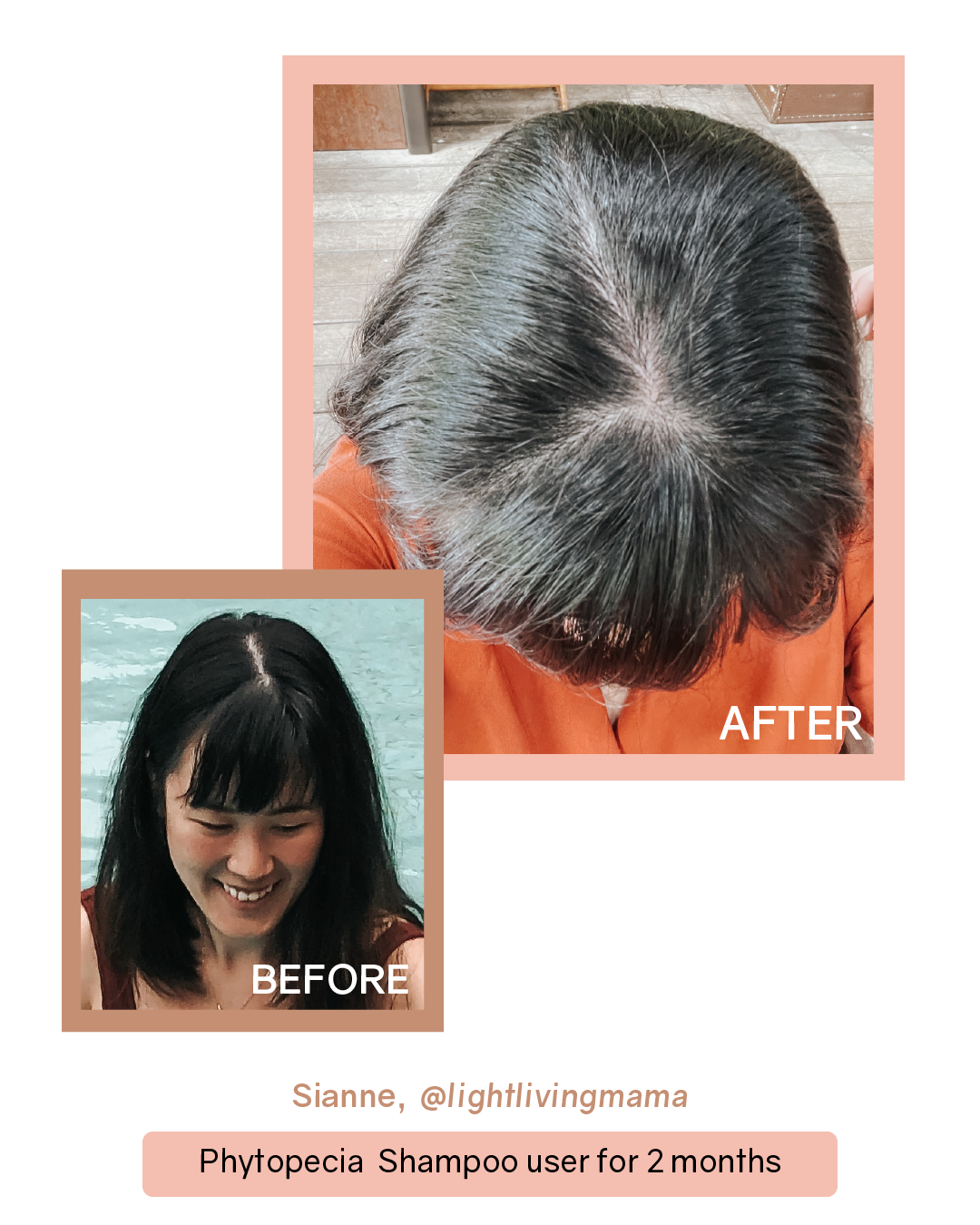 Phytopecia+ Complete Scalp Care Set