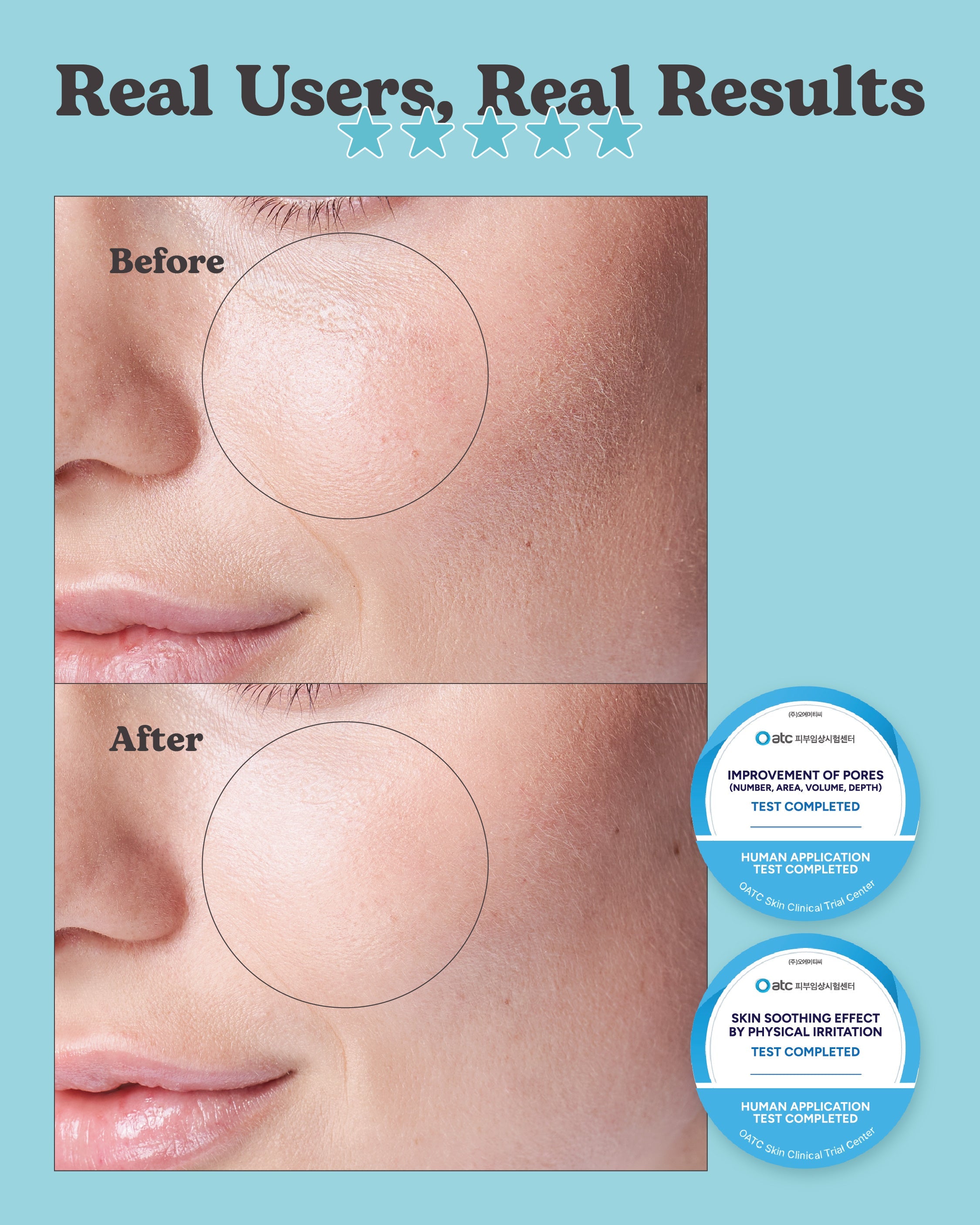 Jung Beauty Pore Minimising Ampoule with Niacinamide, Panthenol & Galactomyces (30ml)